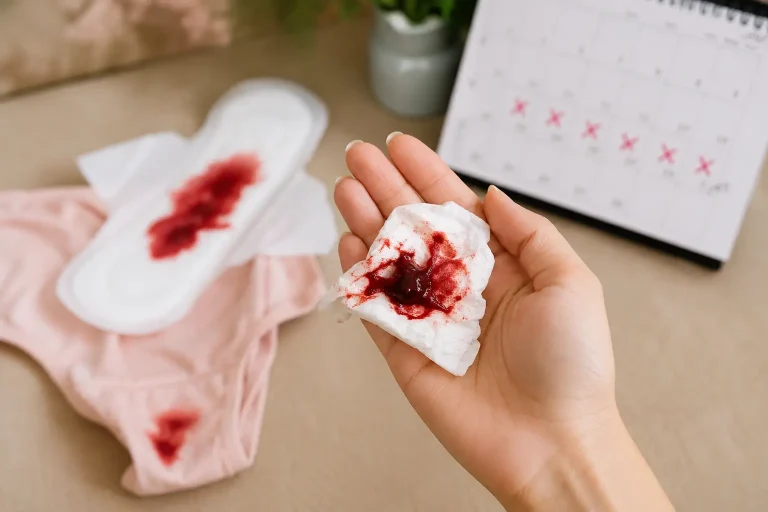 Large blood clots during period shown with menstrual blood on sanitary pad and tissue representing heavy menstrual bleeding symptoms