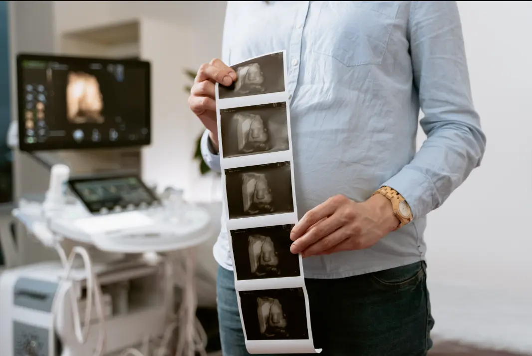 How to Manage Scan Anxiety in Pregnancy After Losing a Previous One