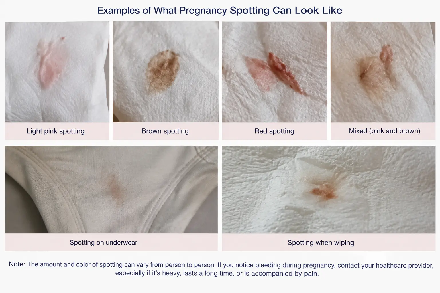What pregnancy spotting may look like on toilet paper and underwear